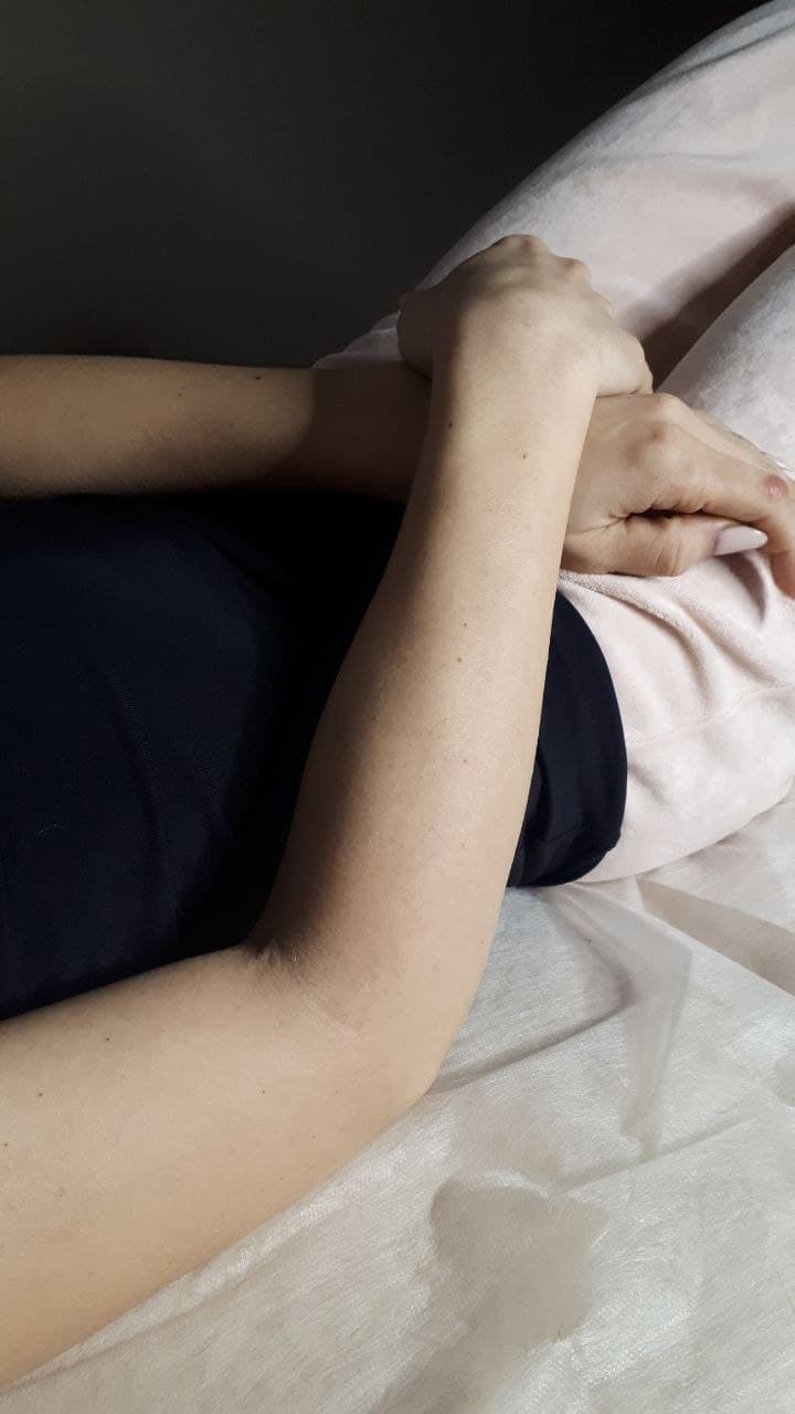 Client receiving a sugaring hair removal treatment on the arm